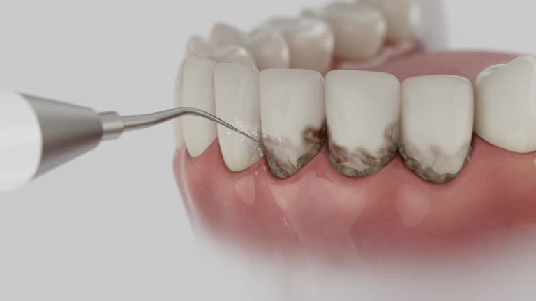 Reliable Dental contractor in St. Matthews, KY by Smile Center Dentistry